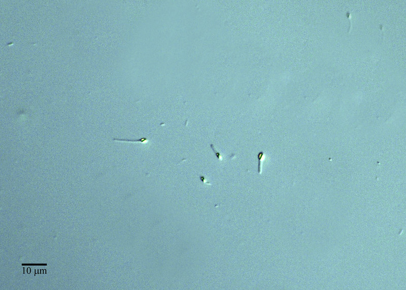 Endosporas: La Estrategia de Supervivencia de las Bacterias